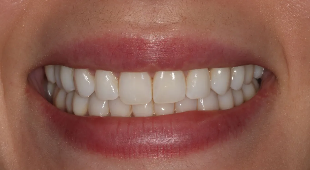 After: J.L.'s smile restored