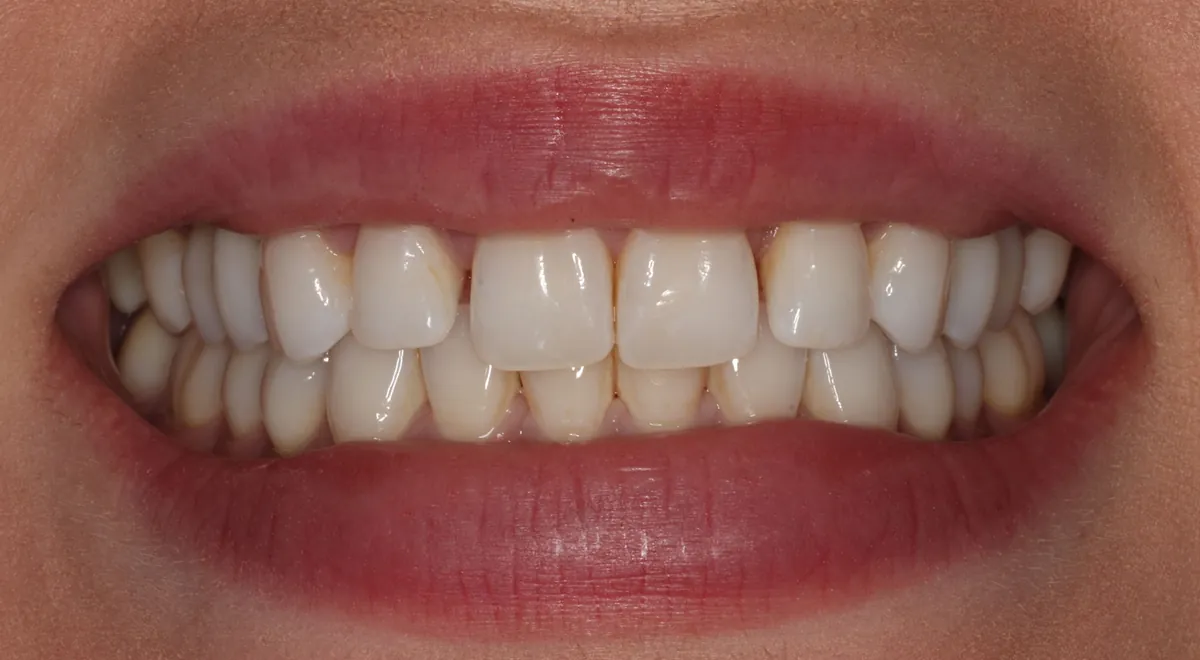 Before: J.L.'s smile