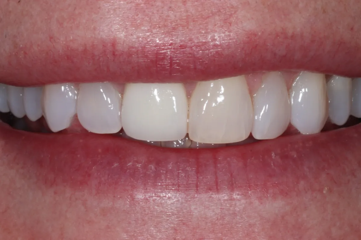 Before: P.C.'s smile