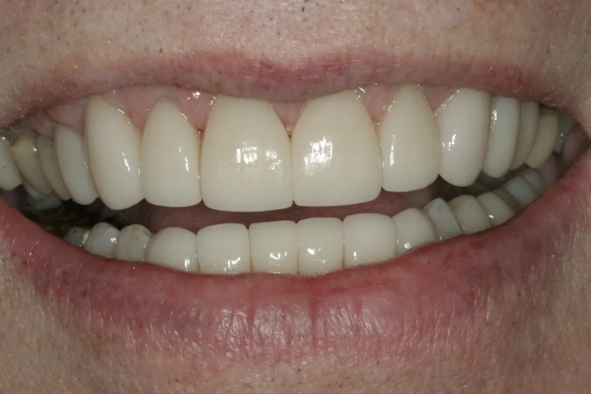 After: S.C.'s smile restored