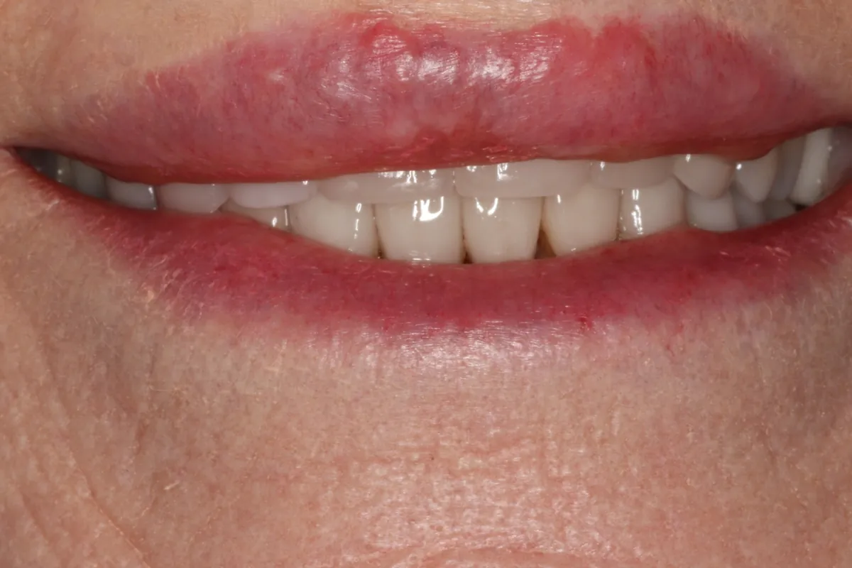 Before: S.M.'s smile