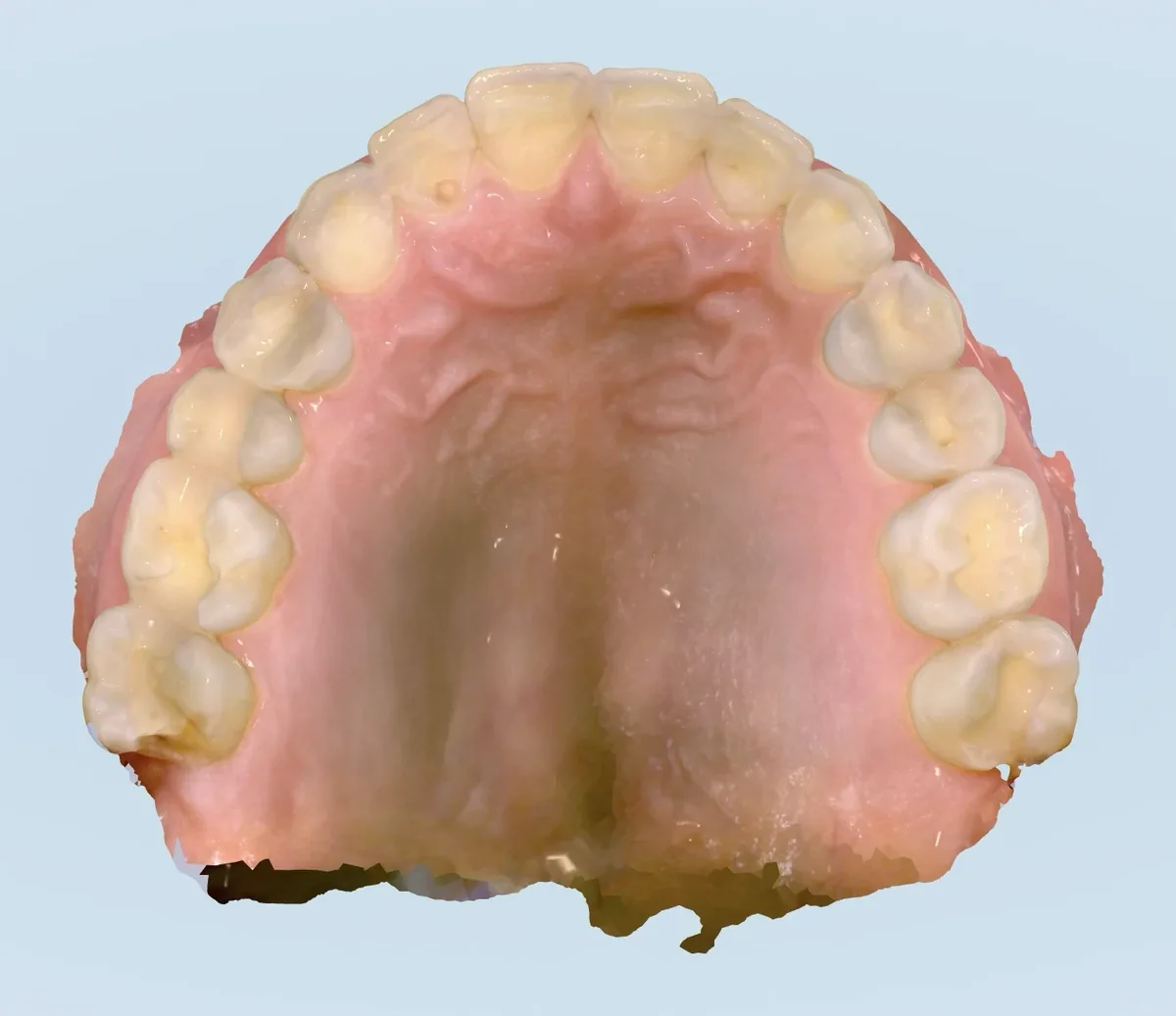 Occlusal view of a 3D intraoral scan of an upper arch, showing the palate, the rugae and the biting surfaces of every tooth.