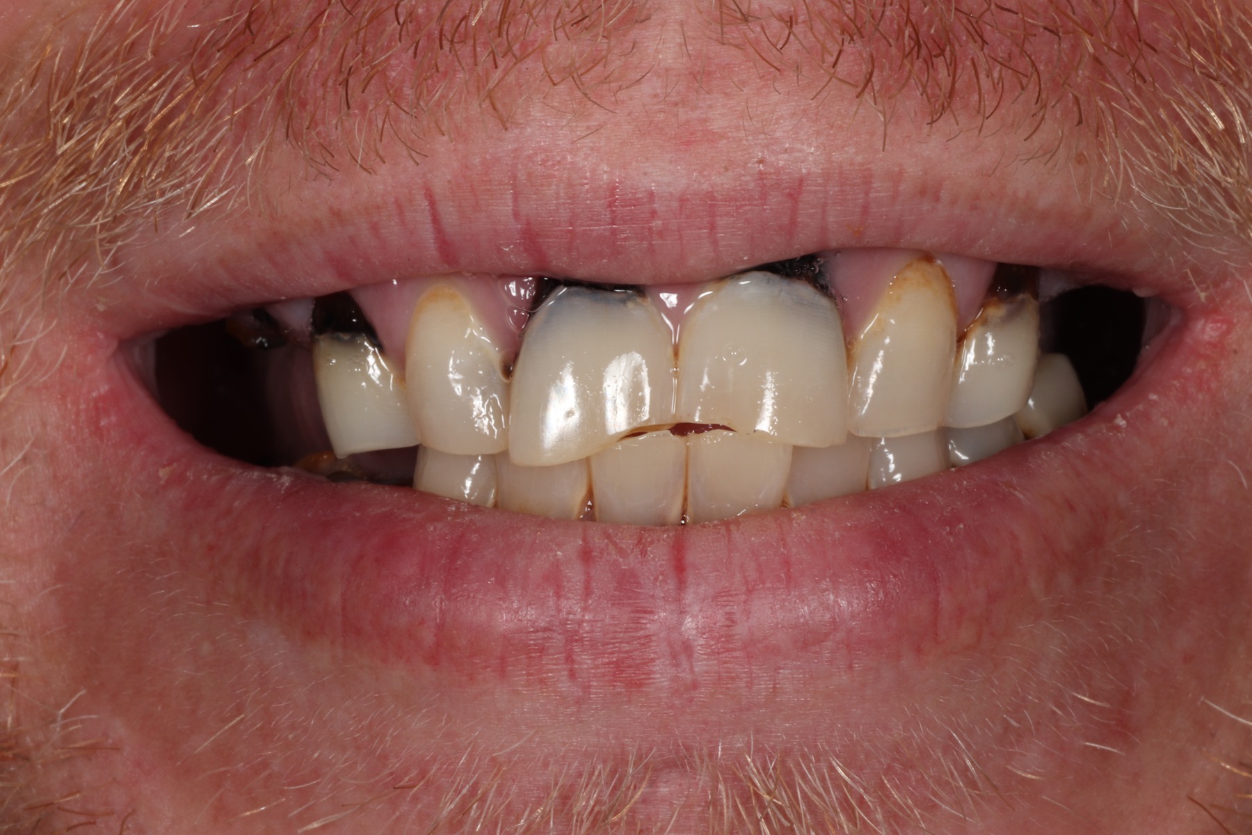 Before: Derek's smile