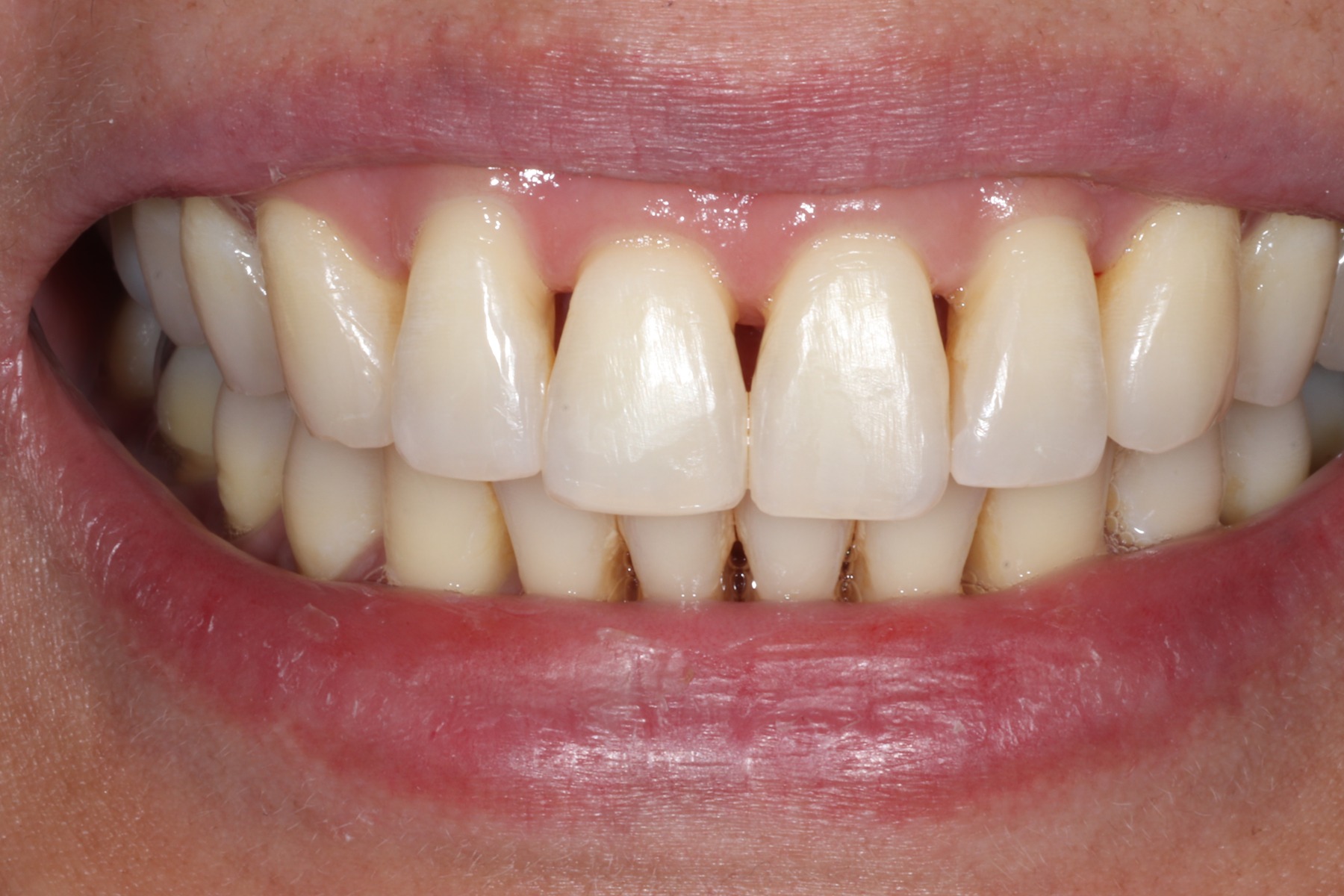 Before: E.C.'s smile