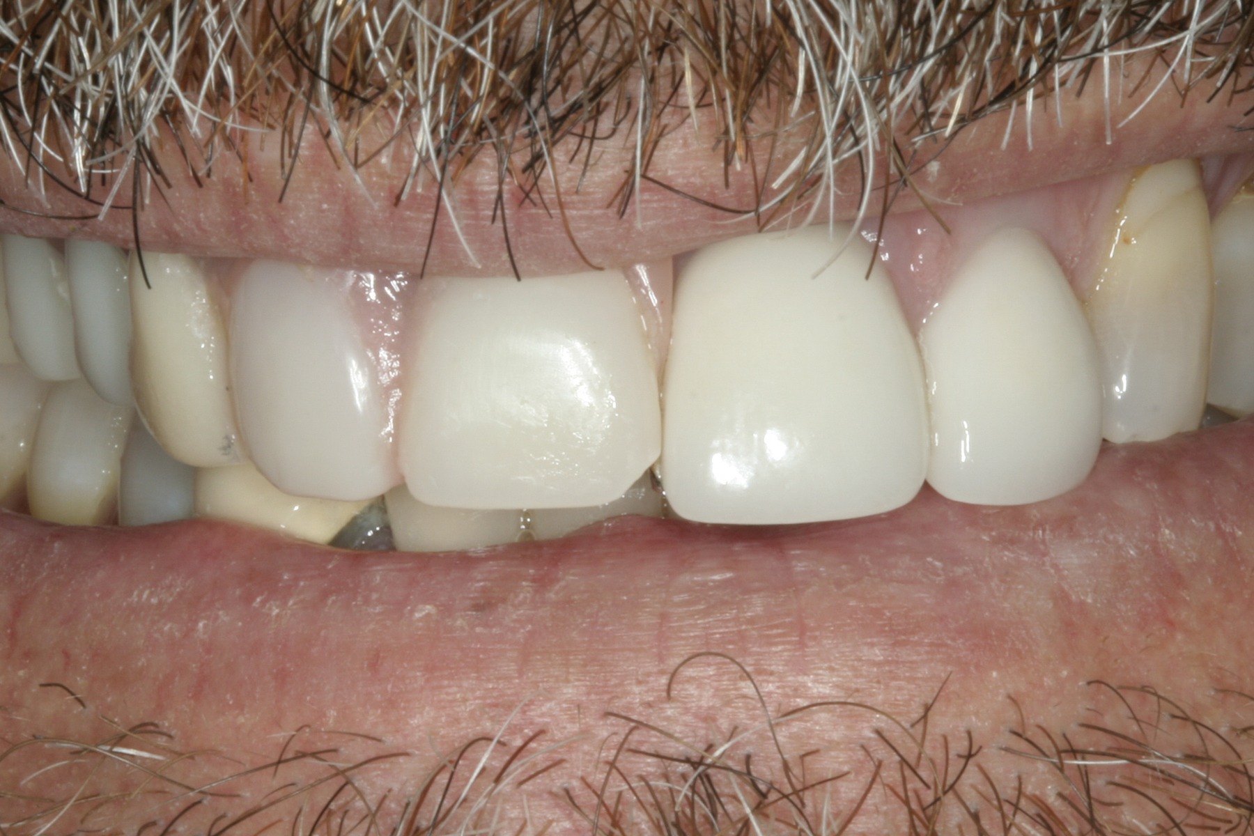 Before: G.B.'s smile