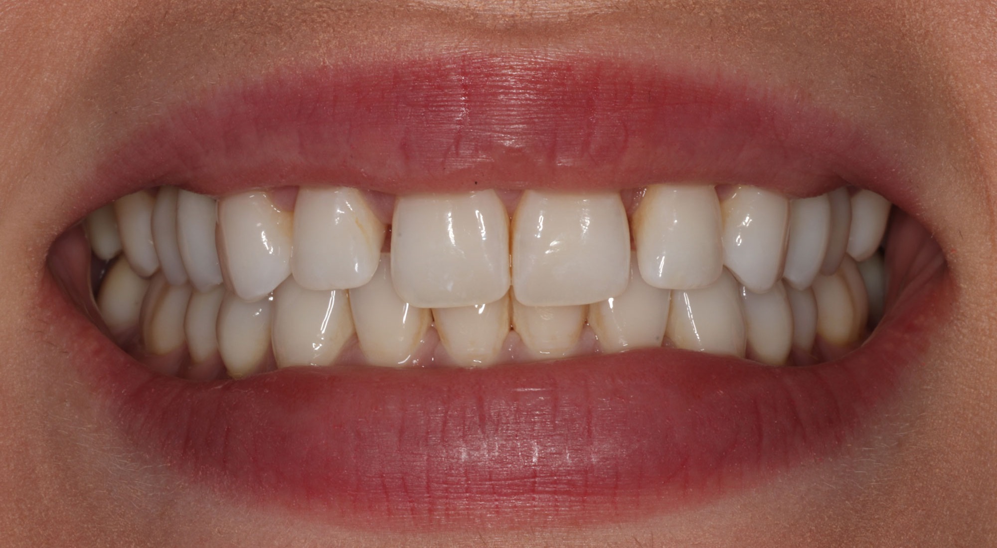 Before: J.L.'s smile