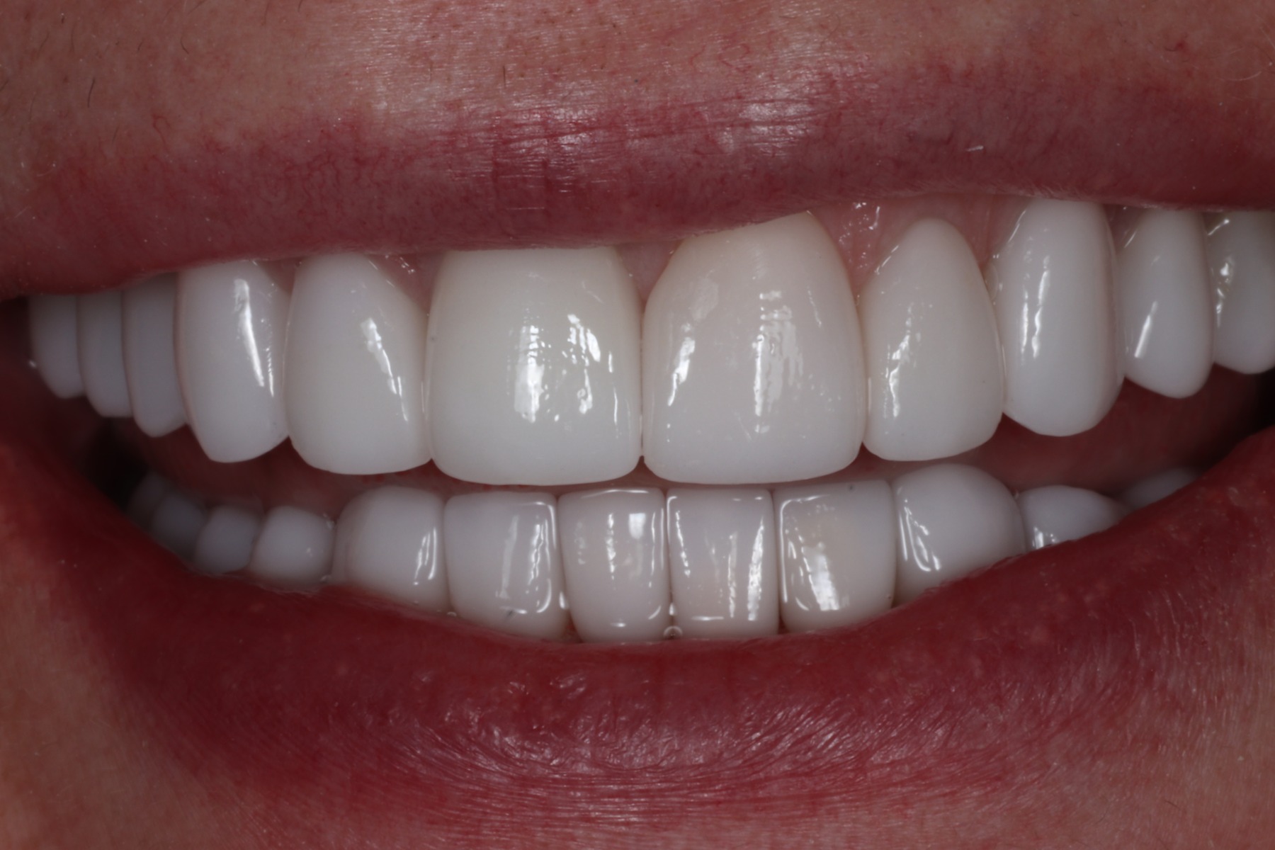 After: P.C.'s smile restored