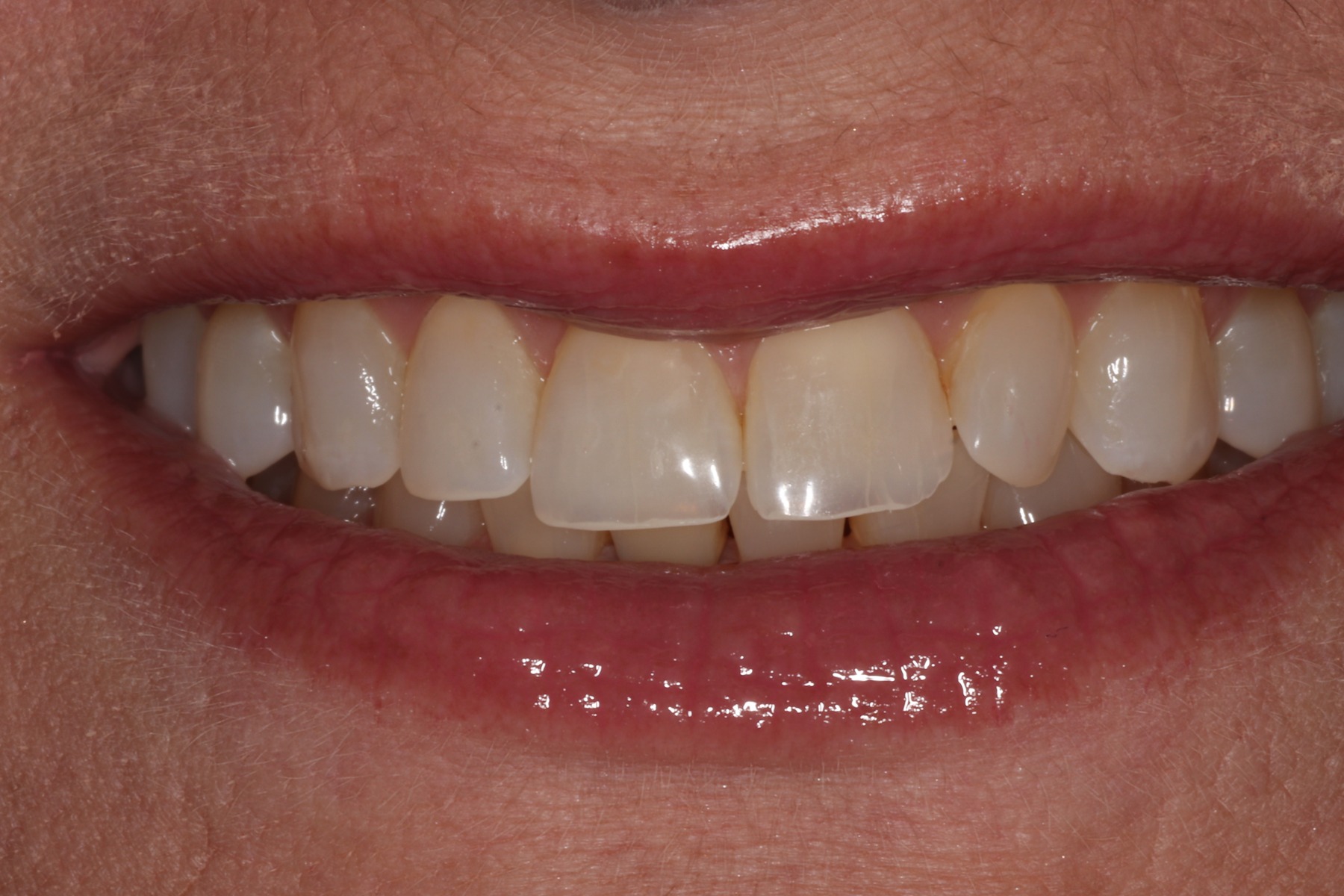 Before: P.M.'s smile