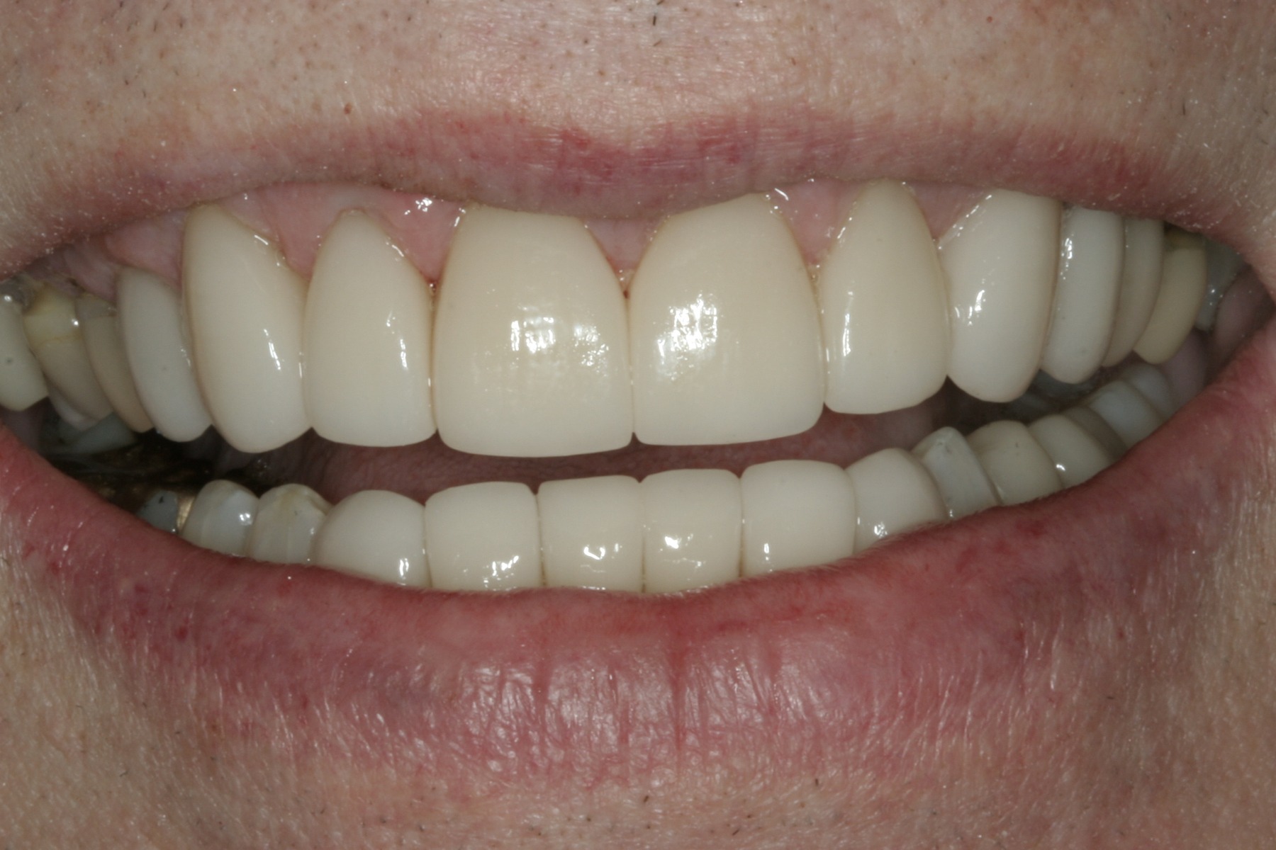 After: S.C.'s smile restored