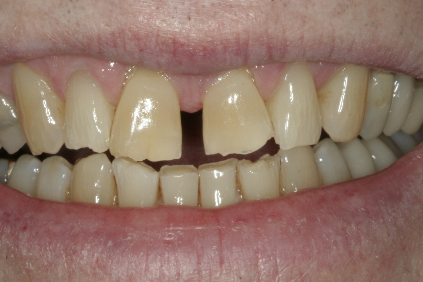 Before: S.C.'s smile