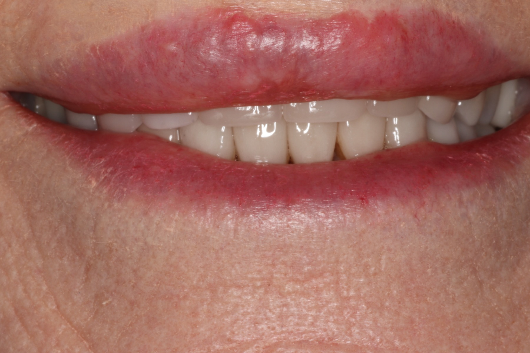 Before: S.M.'s smile