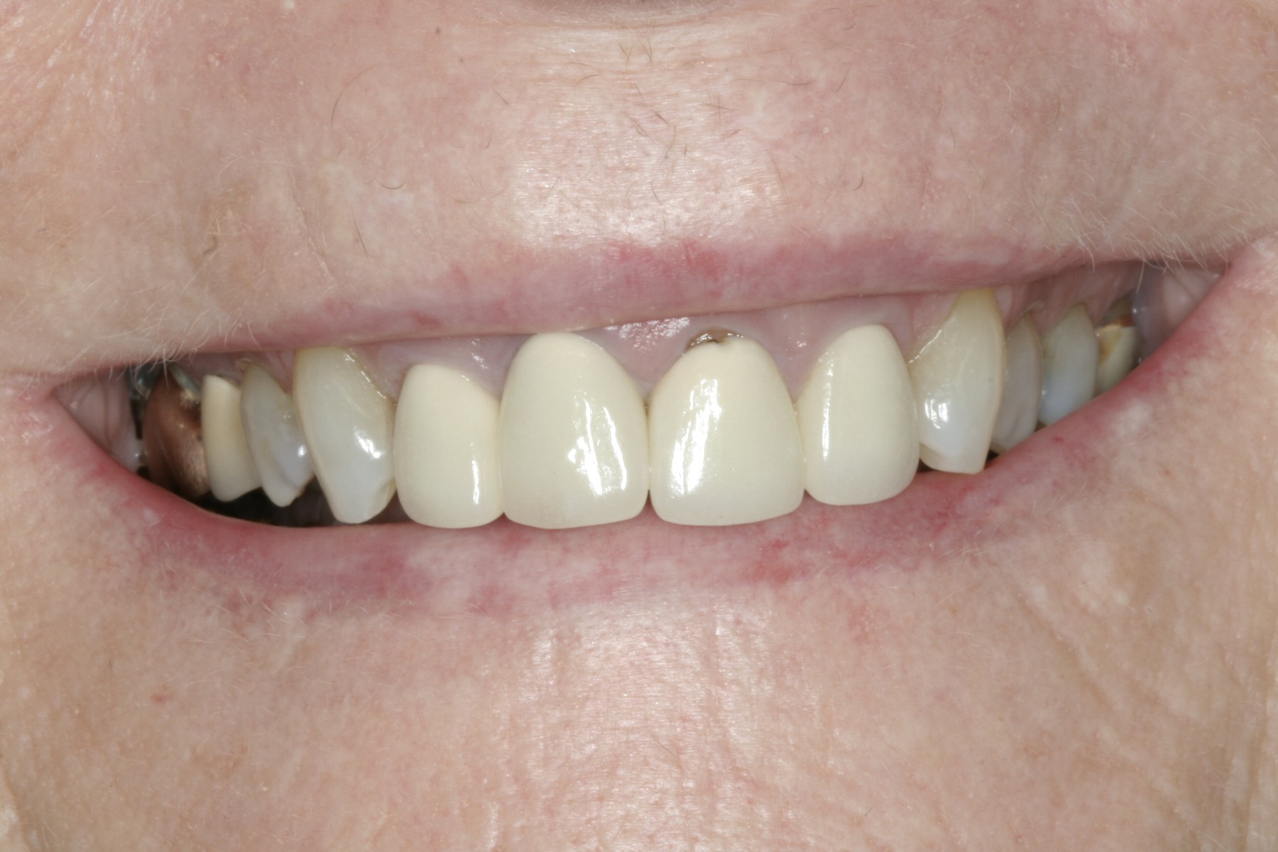 Before: J.B.'s smile