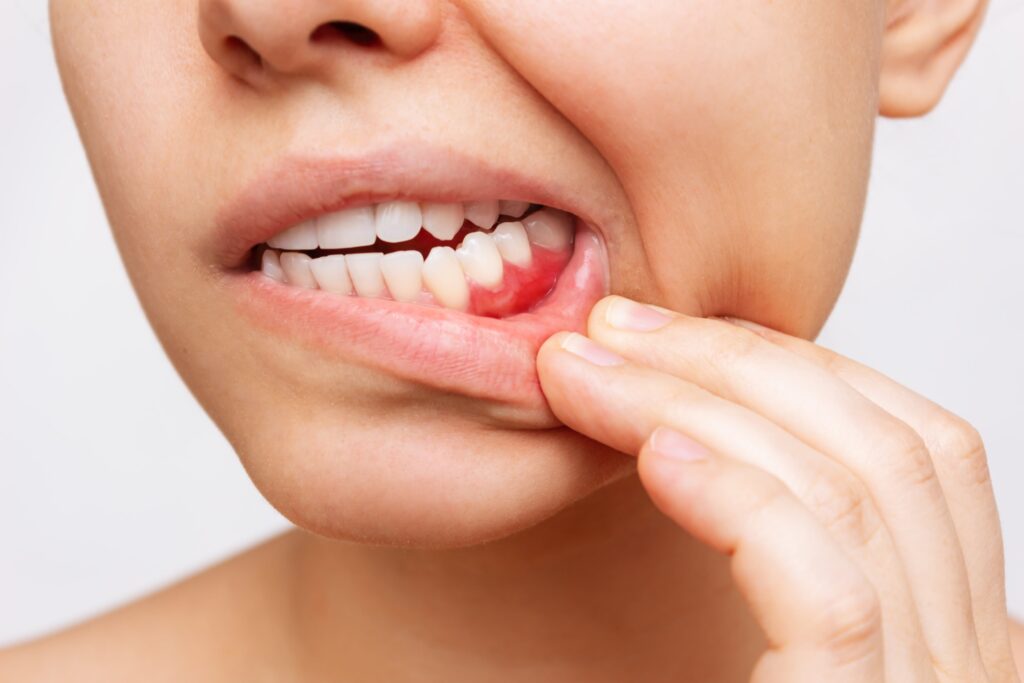 How Healthy Are Your Gums Really?